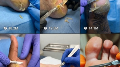 AI generated dead skin removal heel cleaning macro video tutorial