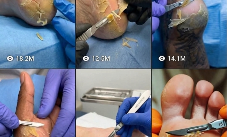 AI generated dead skin removal heel cleaning macro video tutorial